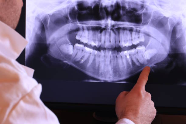 Best Emergency Dentist for Knocked-Out Tooth in Enon, VA